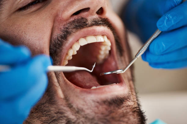 Best Weekend Emergency Dentist in Villa Ridge, MO