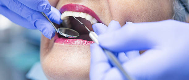 Best Broken or Cracked Tooth Emergency Dentist in Villa Ridge, MO